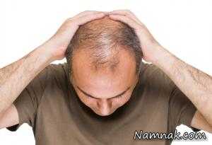 درمان و پیشگیری از ریزش مو با آب آهن دار