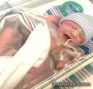 نوزادی که اعضای بدنش بیرون شکمش بود! + تصاویر