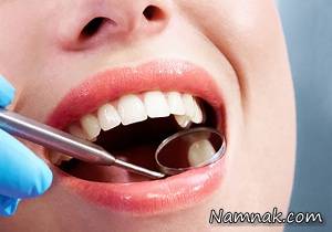 اثرات مخرب دیابت بر بافت دندان ها