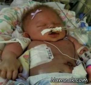 مرگ نوزاد تازه متولد شده براثر بوسیدن! +تصاویر
