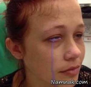 دختری که بعد از تاتو چشم اشک بنفش می ریزد! + تصاویر