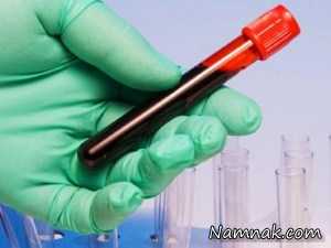 تولید خون مصنوعی برای اولین بار در جهان