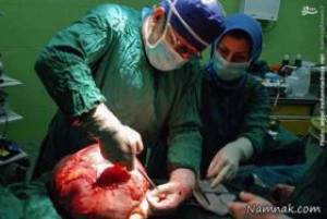 جراحی تومور ۷ کیلویی از کلیه یک زن هندی + تصاویر