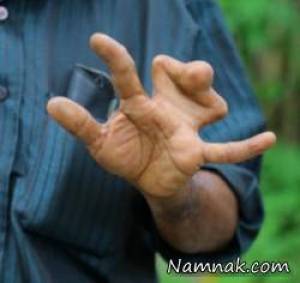 حمله ارواح به انگشتان دست خانواده ای عجیب! + تصاویر