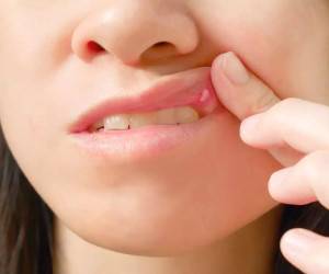 درمان فوری آفت دهان با چند برگ ریحان