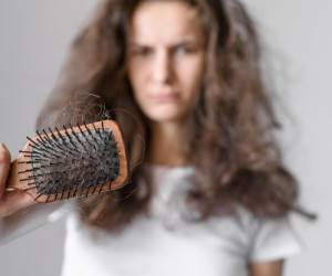 درمان عالی ریزش موی مردانه در زنان !