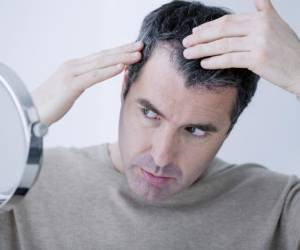 ۸ راه عالی برای درمان ریزش موی شقیقه ها