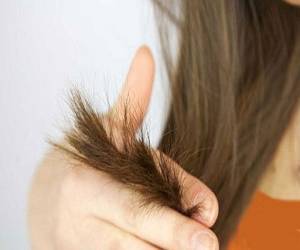 برای درمان موخوره باید موها را کوتاه کرد؟