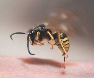 درمان خانگی برای وقتی زنبور نیشمون زده