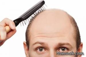 روش جدید برای درمان ریزش مو و کچلی