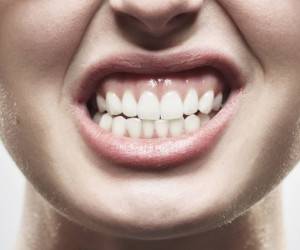 علائمی که ثابت می کند دندان قروچه شبانه دارید