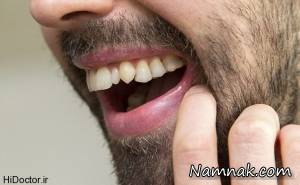 موثرترین و طبیعی ترین روش سفید کردن دندان + دستورالعمل