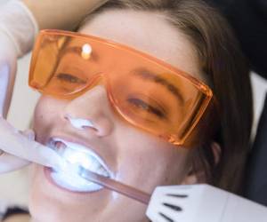 مشکلاتی که دندانپزشک با لیزر درمان می کند