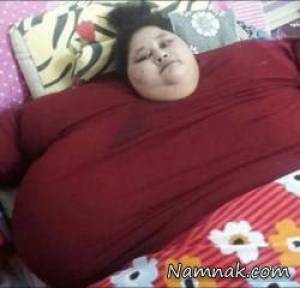 زن ۵۰۰ کیلویی ۲۵۰ کیلو لاغر شد + تصاویر