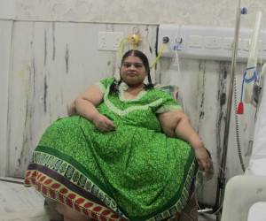 زن ۴۲ ساله رکورد کاهش وزن را زد + عکس