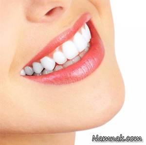 زیبایی دندان با روشی جدید و ارزان