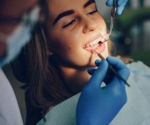 روش های جدید و مد روز زیبایی دندان