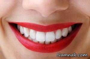 “سفید شدن دندان” در۱ساعت ، ارزان ولی ماندگار