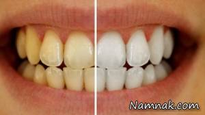 سفید کننده دندان و تسکین درد دندان گیاهی و خانگی