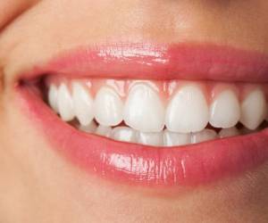 روش ویژه ی سفیدی دندان در کمتر از پنج دقیقه “تضمینی”