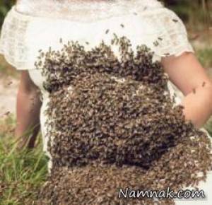 حمله ۲۰٫۰۰۰ زنبور به شکم زن باردار! + تصاویر