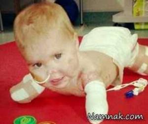 عکس کودک بدون ۴دست و پا و بینی