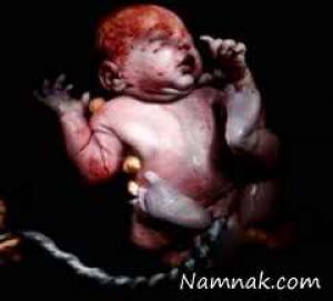 اولین تصاویر از لحظه تولد نوزاد انسان