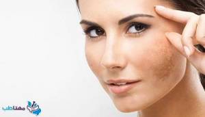 کرم درمان لک های پوستی