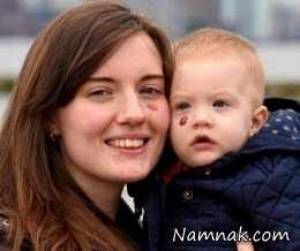 همدردی خاص مادر کودک مبتلا به تومور + تصاویر