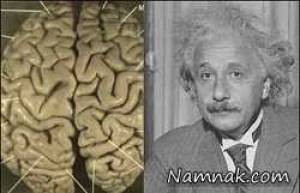 مردی که مغز انیشتین را از سرش خارج کرد! + عکس