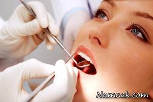 مواد پرکننده دندان چیست؟