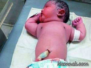 نوزاد پسر ۶ کیلویی در هند به دنیا آمد