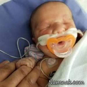 تولد نوزاد بدون چشم همه را شوکه کرد! + عکس
