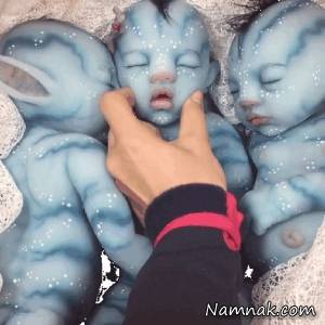 تولد نوزاد عجیب با ۲ چشم خالی  + تصاویر