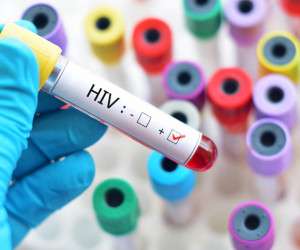 واکسن جدید ایدز HIV امید تازه خلق کرد