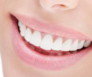 مراحل پر کردن دندان و علت درد بعد از “پر کردن دندان” چیست؟