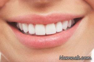 خرد شدن ناگهانی دندان با پوسیدگی دندان ها ارتباط دارد