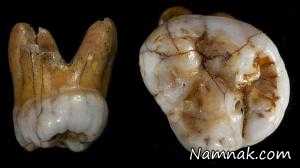 کشف دندان ۱۱۰ هزار ساله انسان در سیبری + عکس