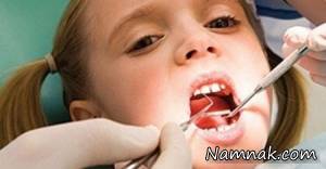 دندان شیری کودک را زودتر از موعد نکشید