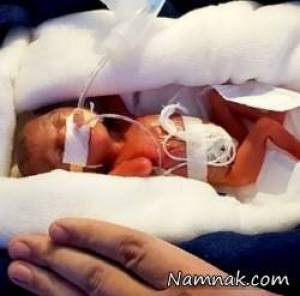 تولد کوچکترین نوزاد به اندازه یک بسته شکلات + تصاویر