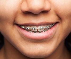 فرق متخصص ارتودنسی با دندانپزشک در چیست ؟