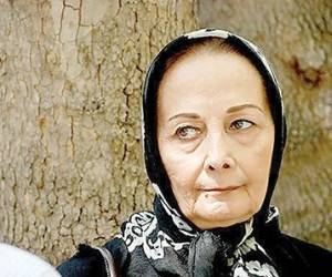 بیماری سرطان بازیگر زن مشهور ایرانی + عکس